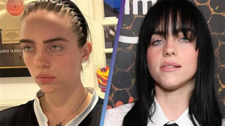 Billie Eilish Plastic Surgery: Did Billie Eilish Alter Her Looks?