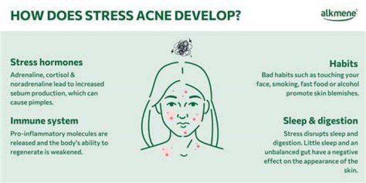 Stress & Anxiety = Acne?